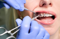 Dra. Maricel Acosta - 20% de descuento ortodoncia